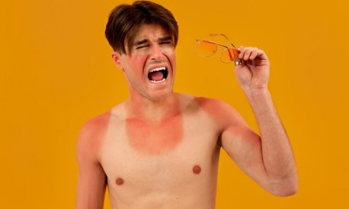 Καταπραΰνοντας τα ηλιακά εγκαύματα με τα έλαια της Φύσης