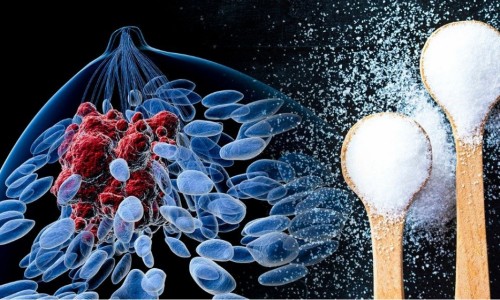 ΑΦΑΙΡΩΝΤΑΣ ΤΗ ΖΑΧΑΡΗ ΑΠΟ ΤΗ ΔΙΑΤΡΟΦΗ ΣΑΣ ΛΙΜΟΚΤΟΝΕΙΤΕ ΤΑ ΚΑΡΚΙΝΙΚΑ ΚΥΤΤΑΡΑ;